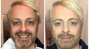 Ehrlich: Ross Antony zeigt sich ohne Make-up auf Instagram