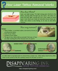 You can begin by looking at the competition in your area, and astanza's experts can help point you in the right direction. 9 Best Laser Tattoo Removal Images Tattoo Removal Laser Tattoo Tattoo Removal Cost