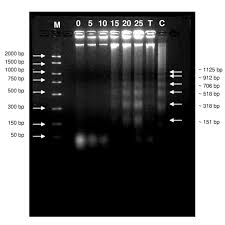 Combined xanthorrhizol-curcumin exhibits synergistic growth inhibitory  activity via apoptosis induction in human breast cancer cells MDA-MB-231