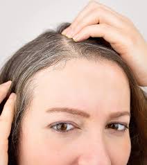Dr mahendra arogya sansthan is one of the best ayurveda panchkarma center in india for best safe effective scientific treatment of vitiligo (सफ़ेद दाग). What Is Poliosis Causes And Treatment