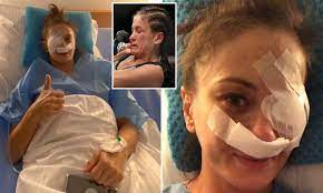 Click to subscribe to lowkick on. Karolina Kowalkiewicz Hopes Mma Career Isn T Over After Having Titanium Plate Inserted In Broken Eye Daily Mail Online