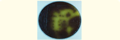 Listeria monocytogenes infection in pregnant women and newborns is a cause for serious concern this trend continues with a recent report of listeria chromogenic agar applied to the diagnosis of. Mox Agar Selective Agar Medium For L Monocytogenes Ss Glucosidase Download Scientific Diagram