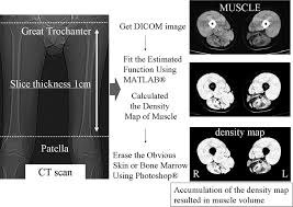 Jul 06, 2021 · there are a lot of muscles of the hip and thigh. Ct Scan Of Thigh Muscles Ct Scan Machine