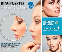 Dra. Norma Alicia Zaragoza Leyva: Otorrino