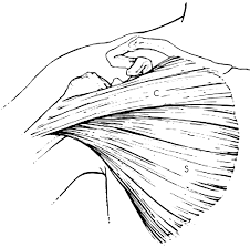 Pectoralis Major Tendon Ruptures When To Operate British Journal Of Sports Medicine