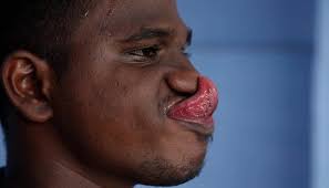 Filipino man skips to his 2nd Guinness World Record