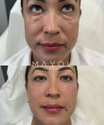 Luis Xavier Mayol Vélez, MD, MPH (@drmayol) • Instagram photos and videos