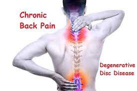Check spelling or type a new query. Jenis Penyakit Kronis Yang Berujung Pada Nyeri Punggung