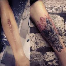 Yara Izi Kapatma Adana Tattoo Gokhan Isisaglam