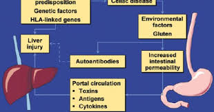 Gluten Intolerance Elevated Liver Enzymes And Liver Damage High Liver Enzymes Elevated Liver Enzymes Lower Liver Enzymes