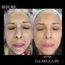 פרופיל של ‏‎Snow Aesthetics‎‏‎