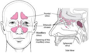 Inside the nasal cavity, the surfaces of the turbinate bones (= nasal conchae) and meatuses are lined by respiratory mucosa (= nasal. Nose And Sinuses Ear Nose And Throat Disorders Merck Manuals Consumer Version