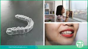 So sánh 3D Cleara và mắc cài truyền thống lựa chọn nào tốt?