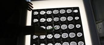 So if you are cancer and are planning to launch a new business or make an engagement proposal, best to encircle fridays on the calendar which fall on these dates! Why The Causes Of Cancer Are More Than Just Bad Luck World Economic Forum