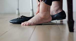 How To Treat Swollen Feet, Ankles And Legs - Certified Foot