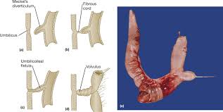 Image result for Umbilicus botryoides
