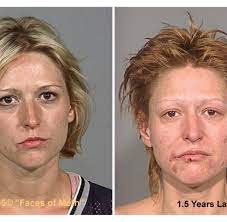 Teufelsdroge Einmaliger Konsum Von Crystal Meth Macht Suchtig Welt