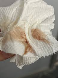 Membrane sweep 38 weeks 5 days - Page 3 | BabyCenter