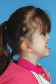 The management and diagnosis of syndromic craniofacial cases