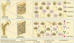 Ageing-related bone and immunity changes: insights into the ...