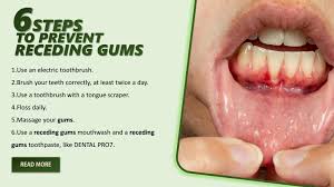 Discover how to stop bleeding gums naturally and permanently without dentist from today. Prevent Receding Gums Getting Worse By Davidmauldin Issuu