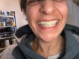 Stephen Ostwald, DDS, 2299 Post St, Ste 101, San Francisco, CA 94115, US