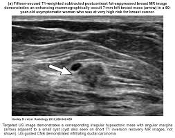 An ultrasound uses sound waves to create a picture of internal organs. Recent Comprehensive Review On The Role Of Ultrasound In Breast Cancer Management Leaders In Pharmaceutical Business Intelligence Lpbi Group