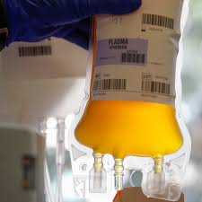 Image result for Plasma Transfusion