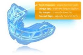 Myobrace Auckland 0800 255 764 All Smiles Dental Mt Eden