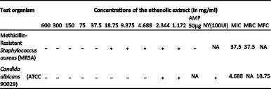 Image result for Pechuel-Loeschea leubnitziae