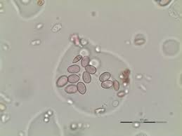 Image result for Botrytis cinerea
