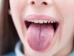 Written by minseo jeong on may 13, 2021. Coronavirus Symptoms These 3 New Symptoms Could Be Early Indicators Of Covid 19 As Per Study