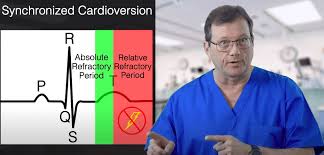Image result for Synchronized Cardioversion