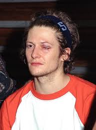 Daryl Selby's freak eye injury sparks new debate