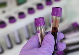 Dieses macht überhaupt keine beschwerden. 5 Langkah Ujian Saringan Hiv Pra Perkahwinan Yang Perlu Anda Tahu