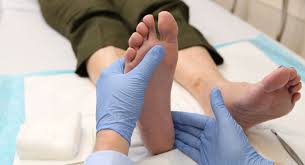 Image result for gout symptoms toe