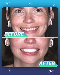 The Smile Mission Fort Lauderdale