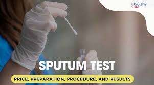 Image result for Sputum