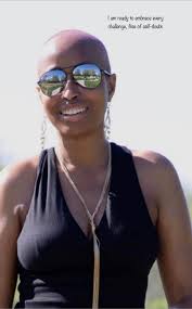 I choose scalp” #baldylocs