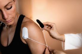 Image result for Electrical Stimulation Therapy