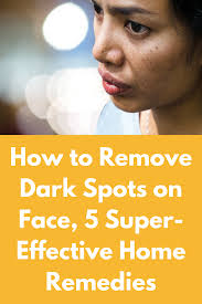 How To Remove Dark Spots On Face 5 Super Effective Home Remedies Be It Excessive Sun Exposure Hormonal C Dark Spots On Face Brown Spots On Face Spots On Face how to remove dark spots on face 5