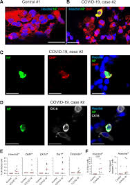 Here are the current coronavirus hotspots, covid exposure sites, venues and case location alerts and what to do if you've visited them. Covid 19 Related Anosmia Is Associated With Viral Persistence And Inflammation In Human Olfactory Epithelium And Brain Infection In Hamsters Science Translational Medicine