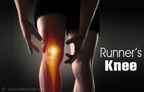 Image result for knee injury patellofemoral syndrome