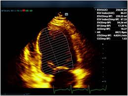 2024 Midwest Clinical & Translational Research Meeting Abstract Supplement,  2024