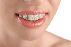 Here are a few tips on how to get rid of braces pain eat soft foods avoid foods such as crunchy and hard foods like raw vegetables and chips that will further irritate your mouth. The Pros And Cons Of Ceramic Braces Belmont Smiles Orthodontist Belmont Ma