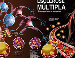 Site com informações atualizadas e precisas sobre esclerose múltipla. Esclerose Multipla Projects Photos Videos Logos Illustrations And Branding On Behance
