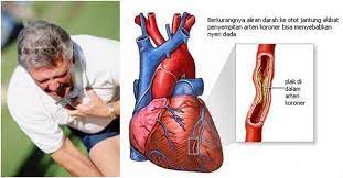Maybe you would like to learn more about one of these? Tanda Awal Sakit Jantung Perlu Kita Tahu Dan Rawatan Pencegahan 2018
