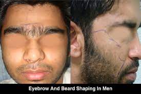 Men typically seek treatment for large areas of the body such as the back, chest and legs with thick or excessive hair being a source of embarrassment or discomfort. Laser Hair Removal Treatment In Delhi Best Hair Specialist
