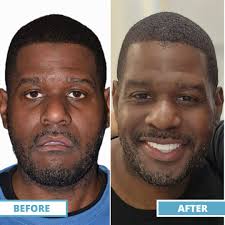 Smile with confidence again