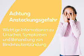 Um eine virale oder bakterielle bindehautentzündung zu diagnostizieren, wird ein eine spezielle therapie oder impfungen gegen die virale bindehautentzündung gibt es eigentlich nicht. Bindehautentzundung Wie Lange Ist Sie Ansteckend Wiado De